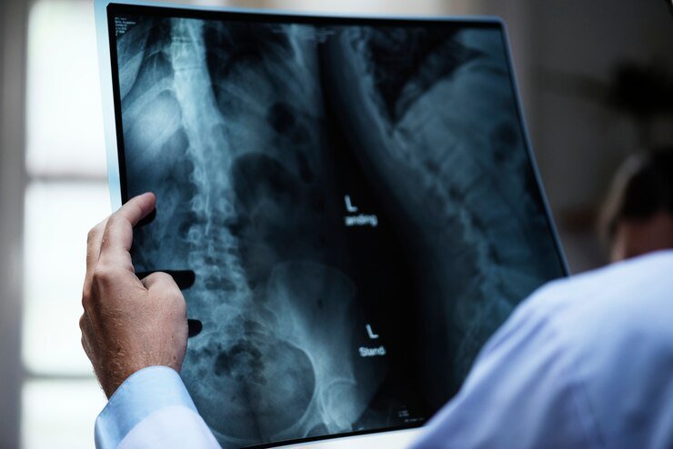 Best bone and nerve doctor in Rajender Nagar